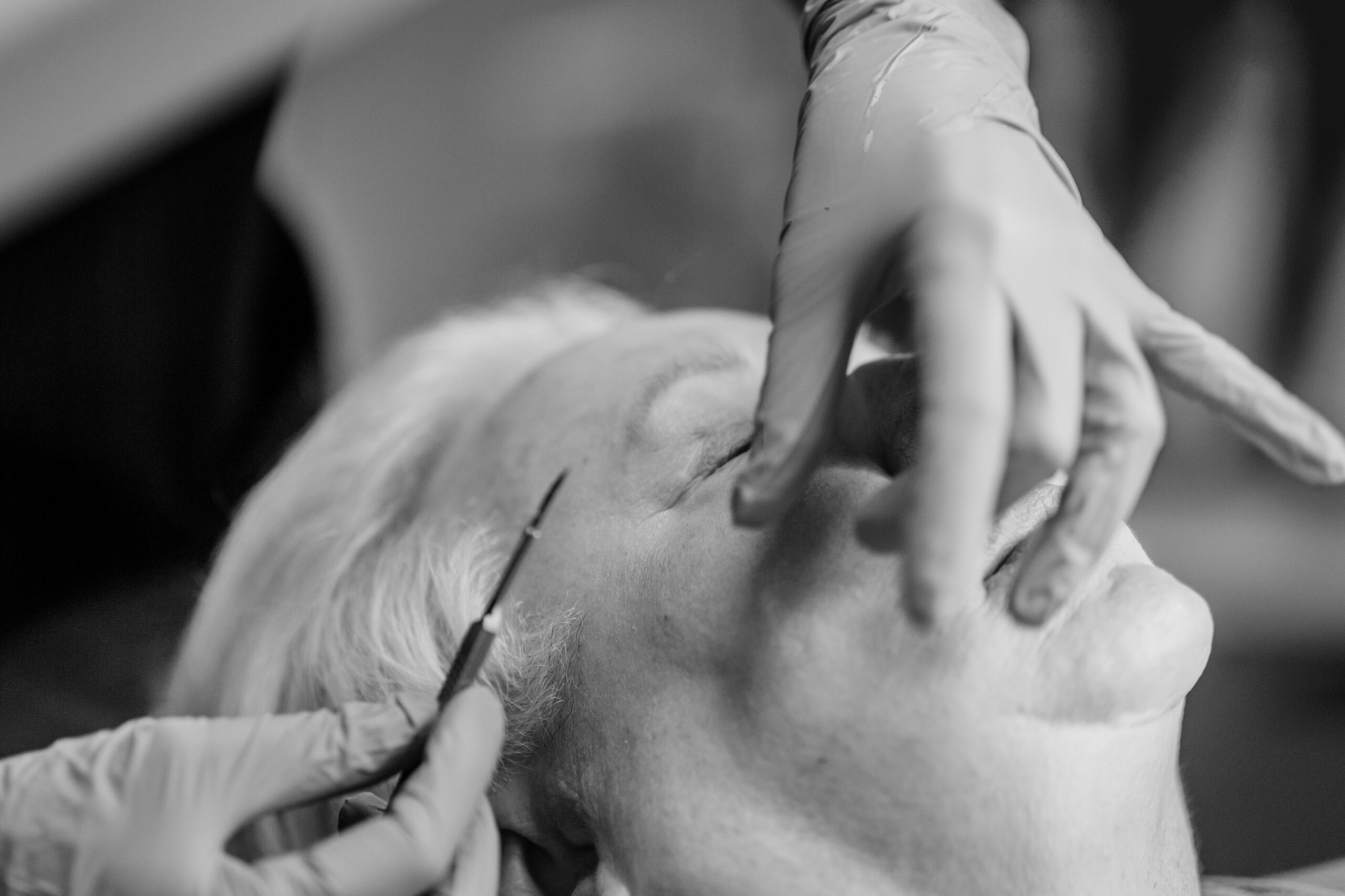 Patient receiving facial treatment at Seiff Center Medispa