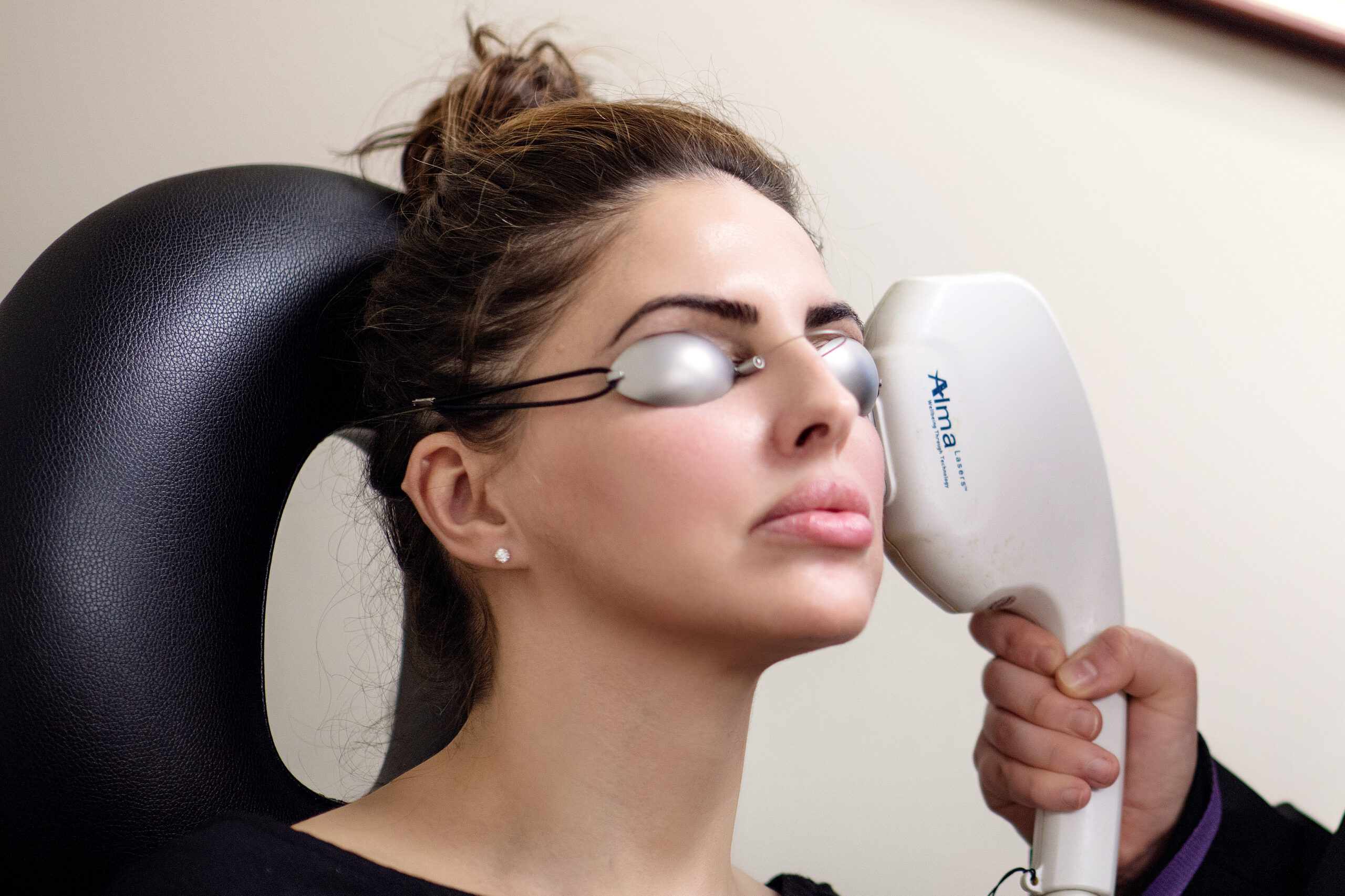 Patient receiving facial laser treatment at Seiff Center medispa