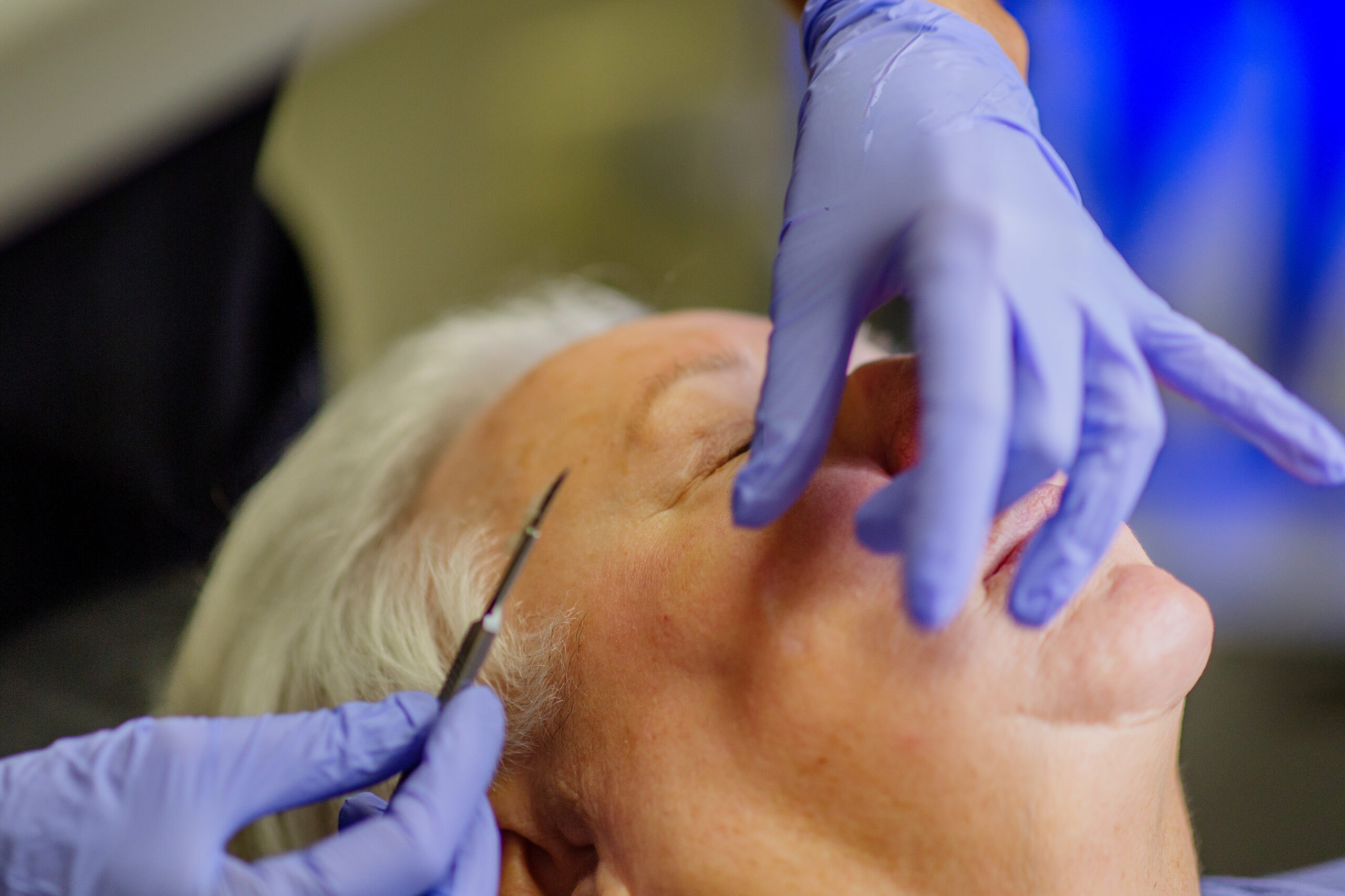 Specialist performing dermaplaning treatment at Seiff Center medispa