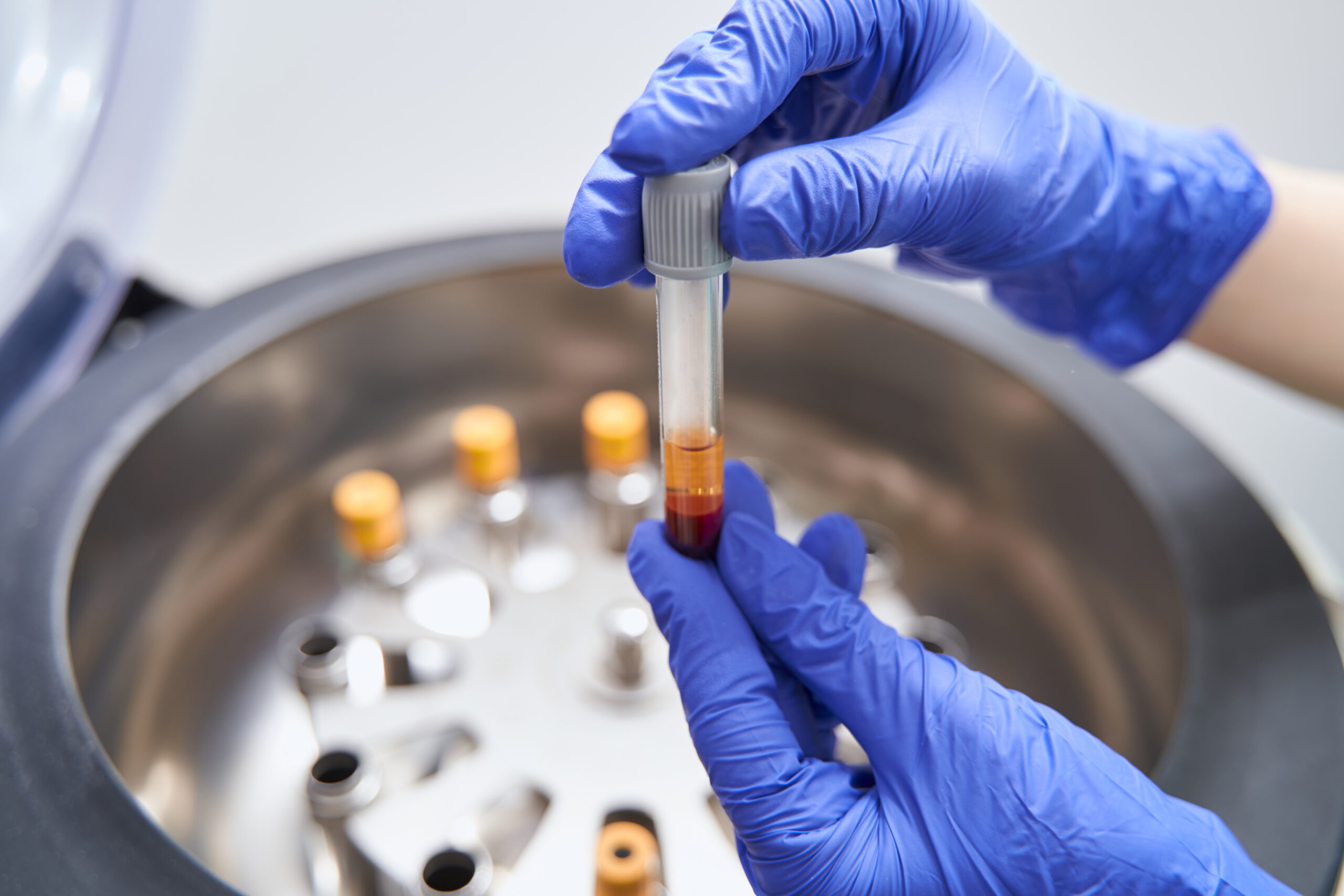 Centrifuge equipment used for advanced skin or hair treatments at Seiff Center