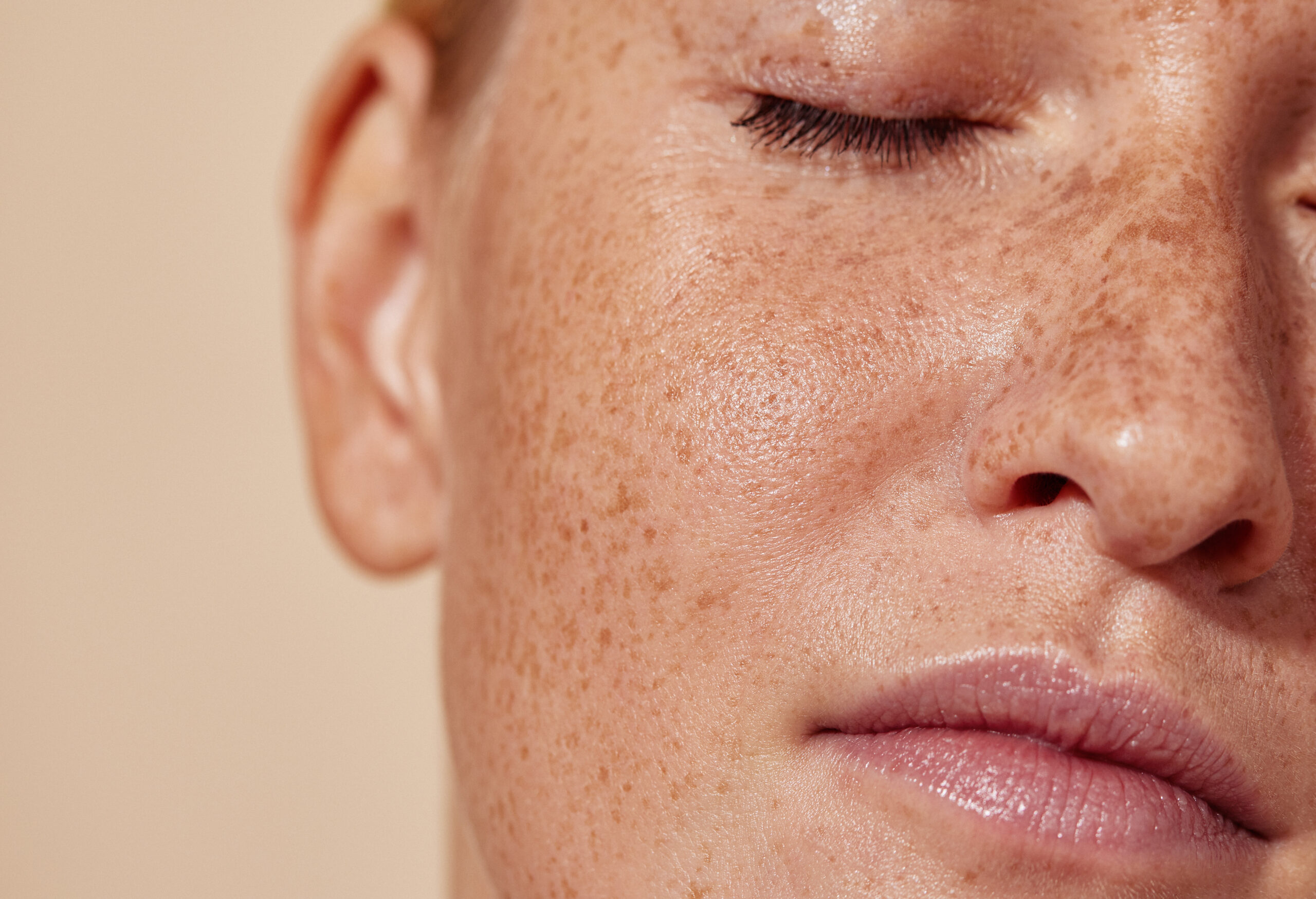 a close up of a woman's face with freckles